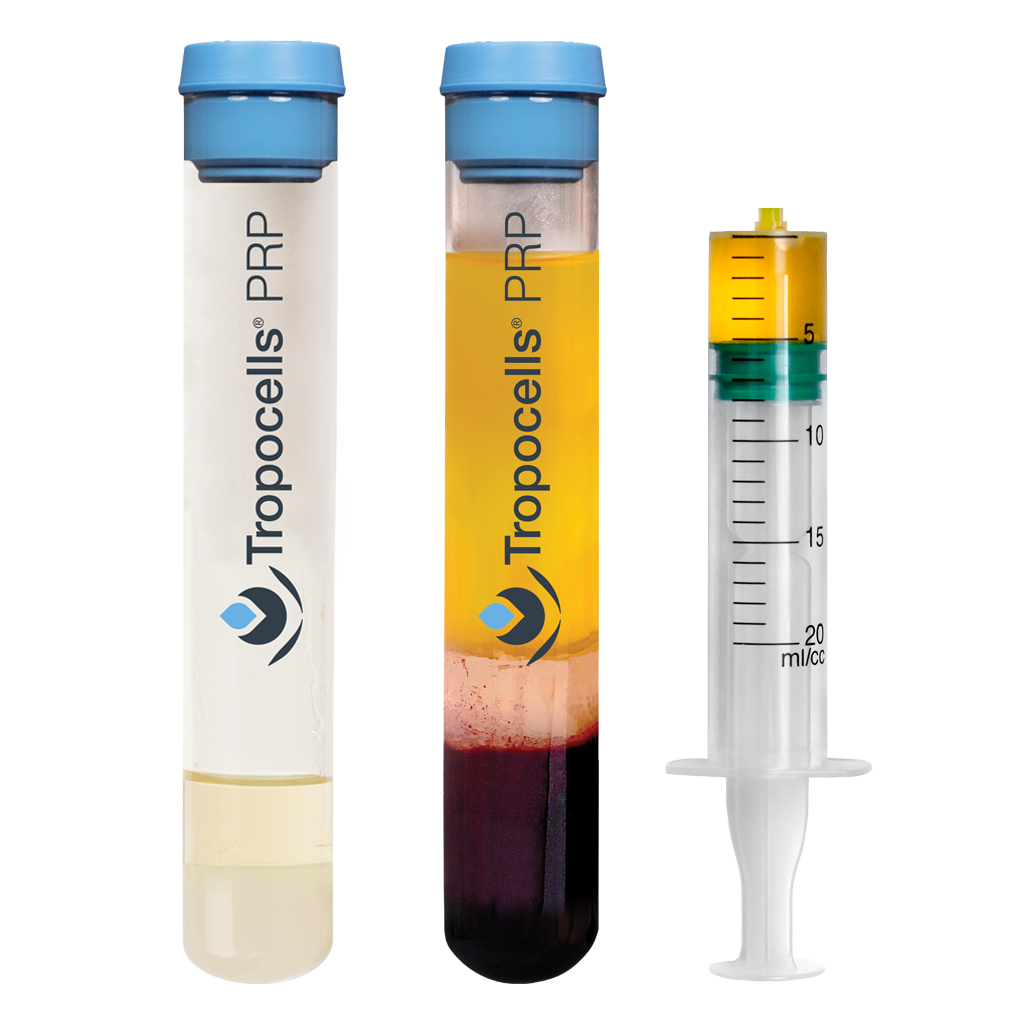 Tropocells PRP