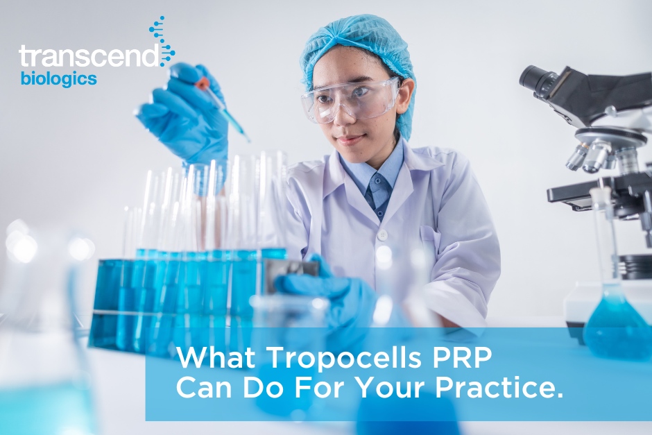 Tropocells PRP (Platelet-Rich Plasma)