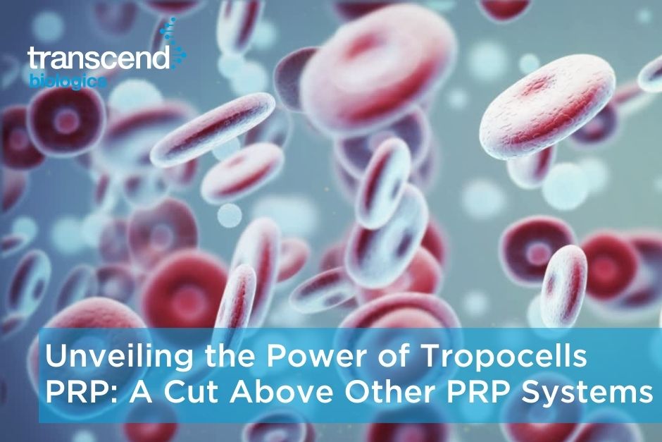 Unveiling the Power of Tropocells PRP: A Cut Above The Rest
