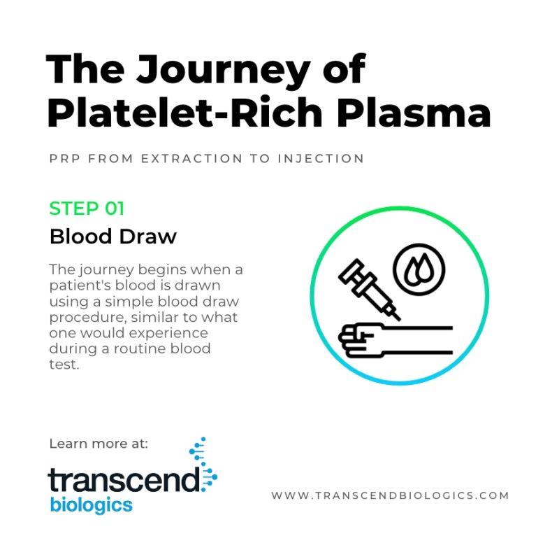 The Journey of Platelet-Rich Plasma Step 1