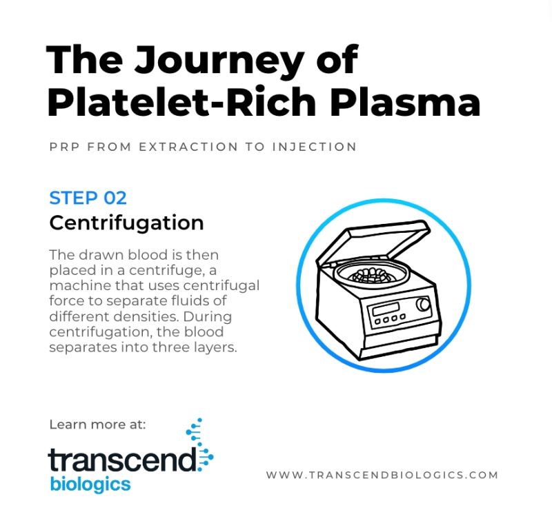 The Journey of Platelet-Rich-Plasma Step 2