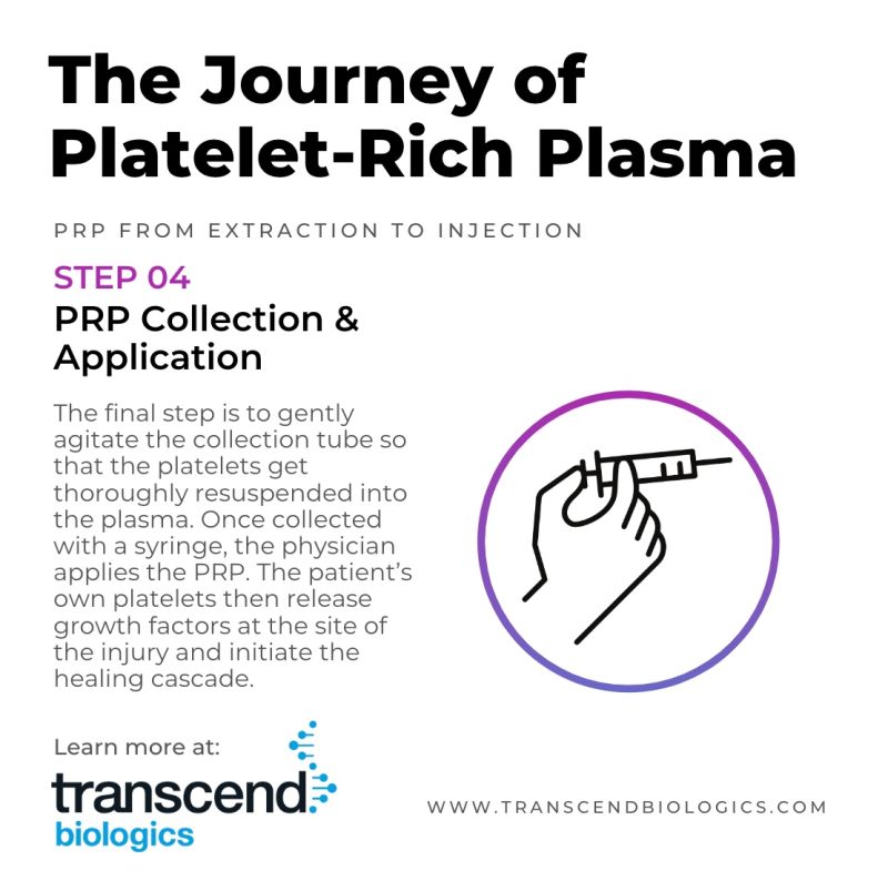 The Journey of Platelet-Rich-Plasma Step 4