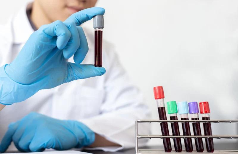 What is Platelet-Rich Plasma & How Does it Work?