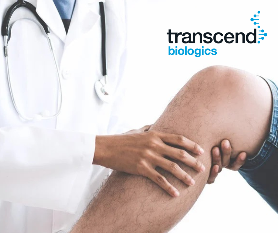 Choose PRP over Corticosteroid Injections