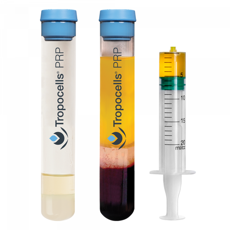 Tropocells PRP Kit